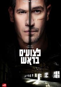 Ptzuim BaRosh thumbnail