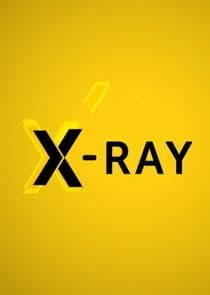 X-Ray thumbnail