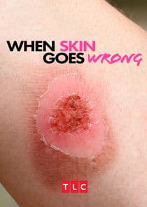 When Skin Goes Wrong thumbnail