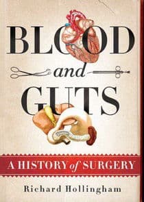 Blood and Guts: A History of Surgery thumbnail