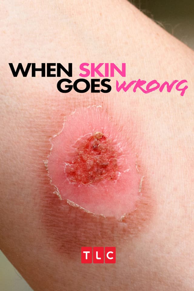 When Skin Goes Wrong